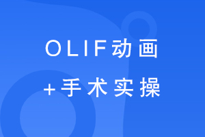 OLIF+ʵ