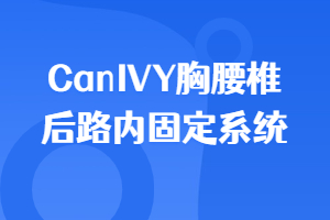 CanIVY׵·ڹ̶ϵͳ